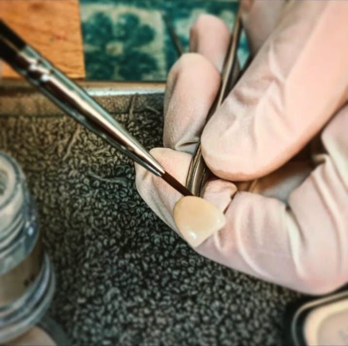 Sillón dental con monitor que muestra una radiografía en un consultorio dental moderno y luminoso.