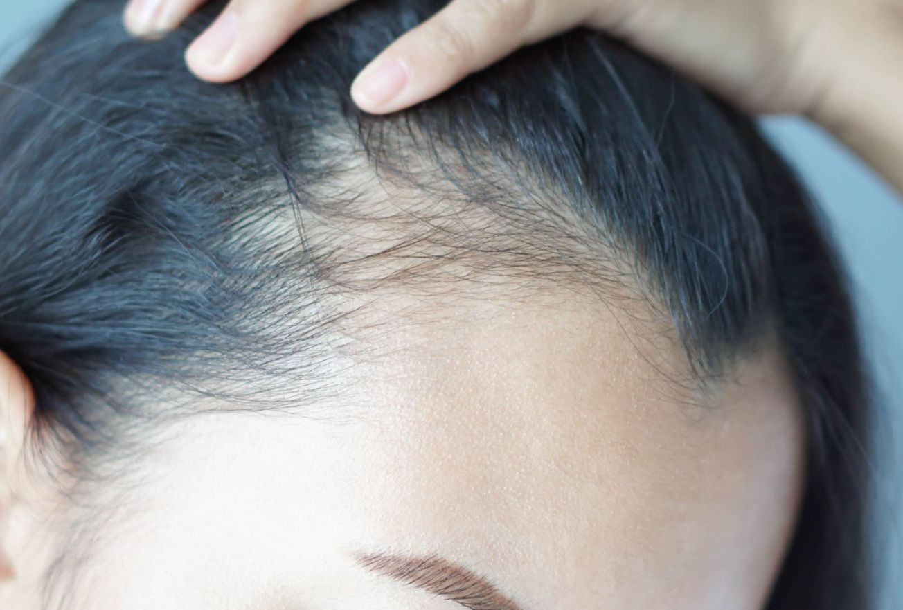 Un primer plano de la cabeza de una mujer con una mano en su cabello.