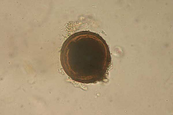 Un primer plano de un círculo marrón sobre una superficie blanca bajo un microscopio.
