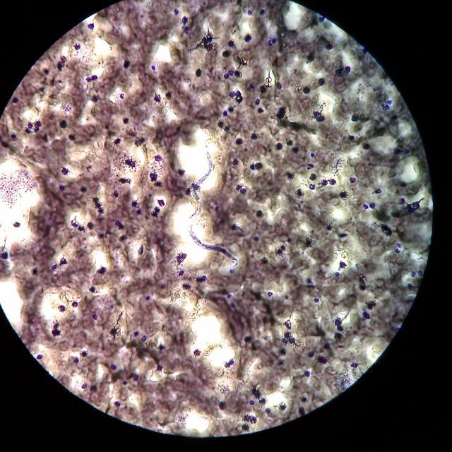 Un primer plano de una célula bajo un microscopio.