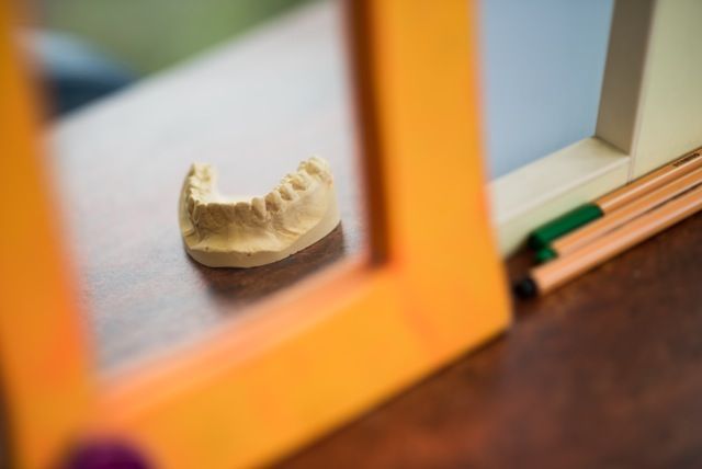 Zahnmodell auf einem Holztisch, gesehen durch einen orangefarbenen Rahmen mit weicher Hintergrundunschärfe.