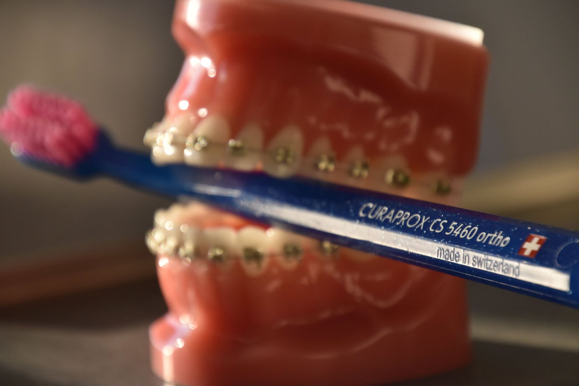 Appareillages orthodontiques fixes – Dr Albert Jung