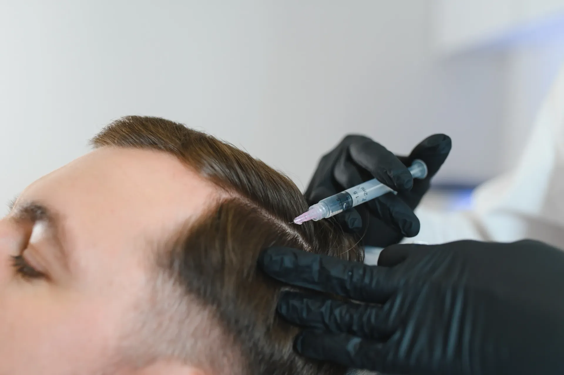 Persona que recibe una inyección para un tratamiento capilar.