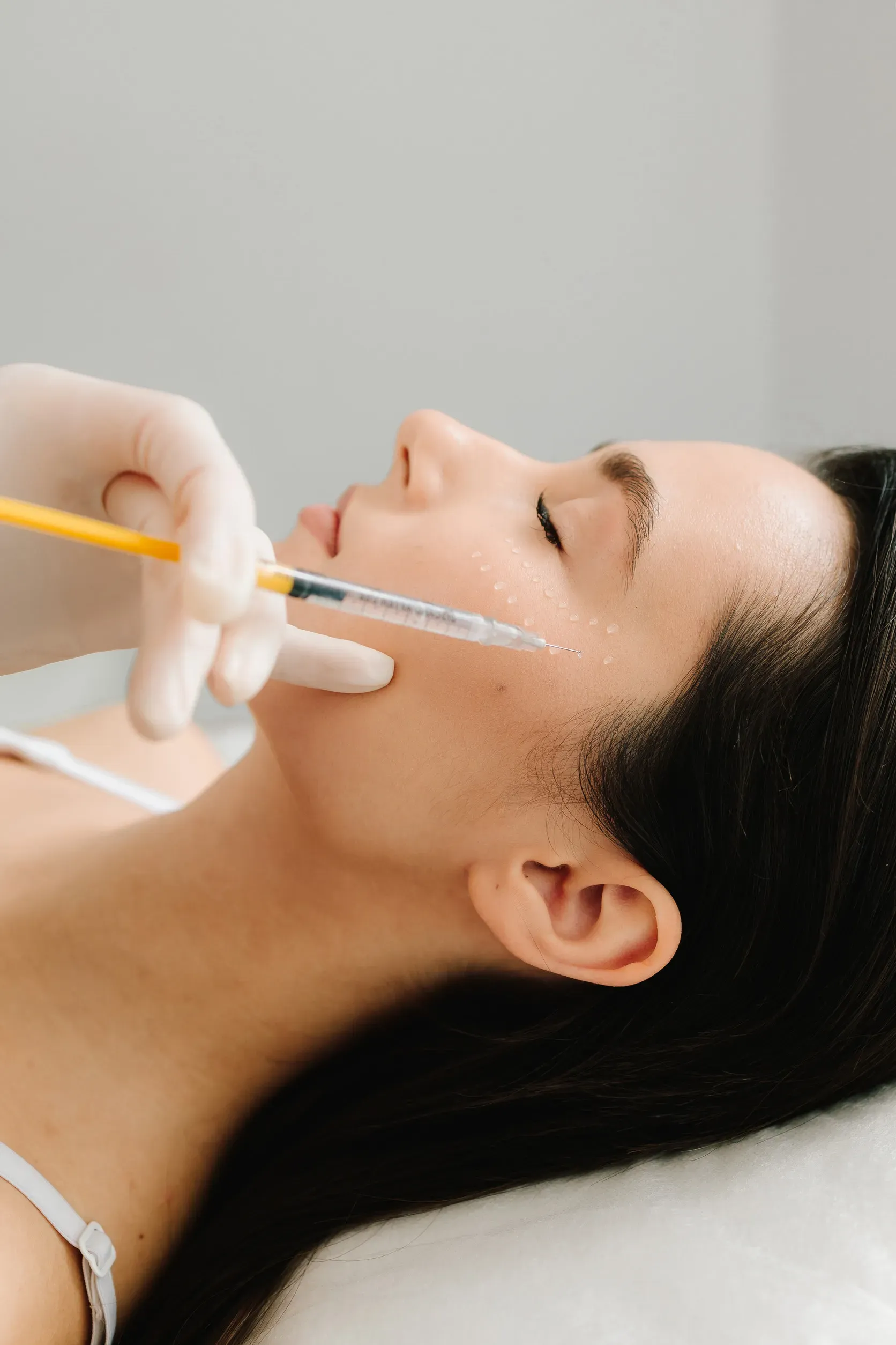 Persona que recibe una inyección facial en un entorno médico; mano enguantada sosteniendo una jeringa.