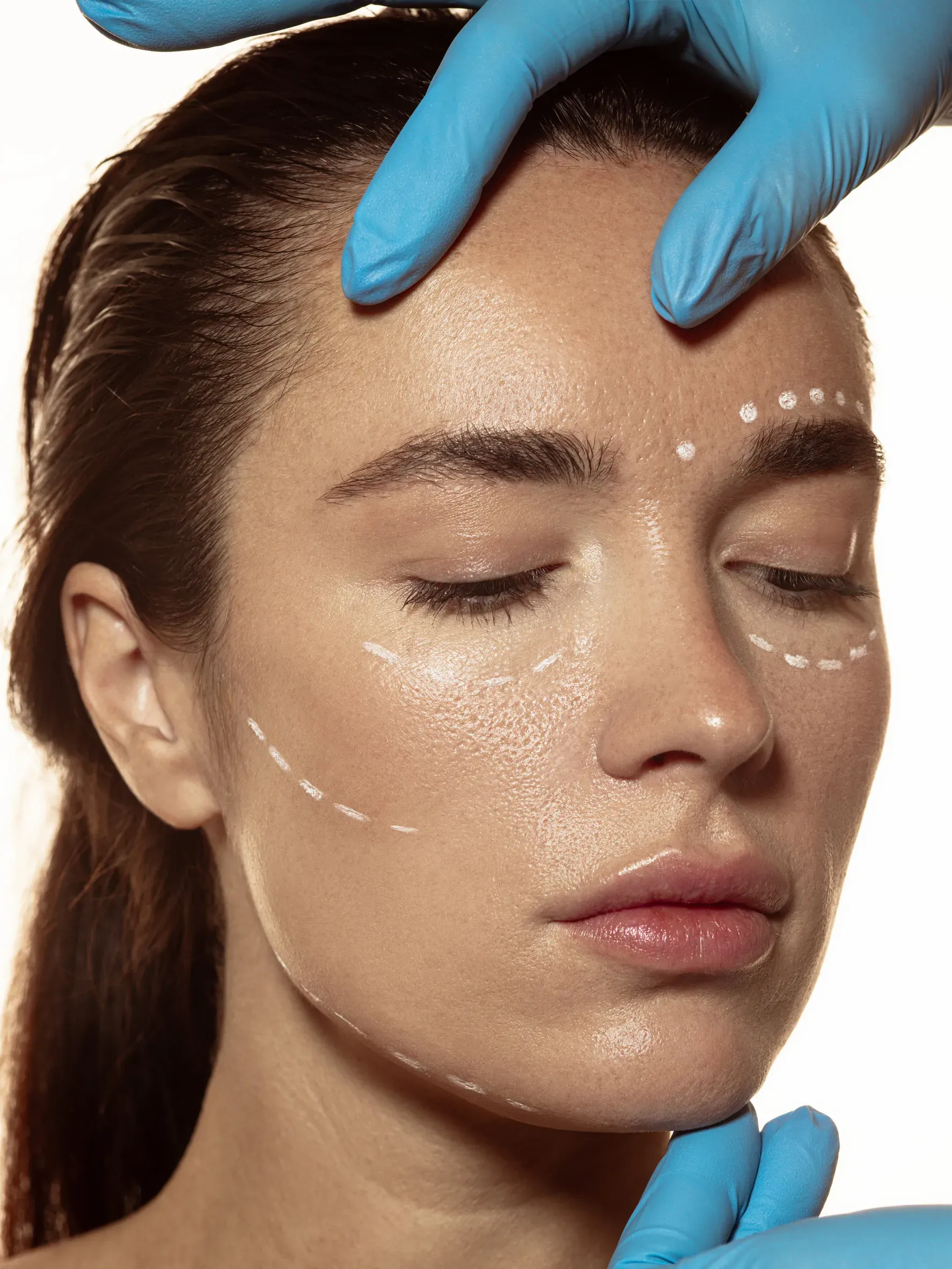 Rostro de mujer con marcas quirúrgicas, tocado con manos enguantadas y ojos cerrados.