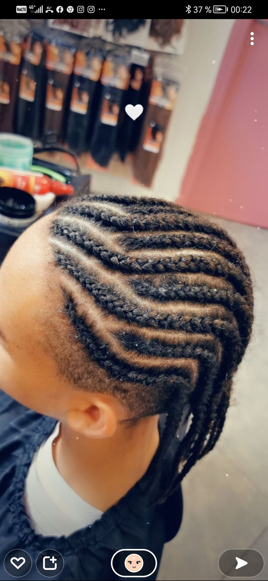 Gros plan sur la tête d'une personne avec des tresses en zigzag et une ligne de cheveux décolorée.