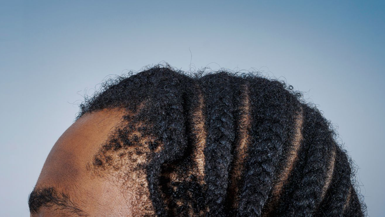 Gros plan sur la tête d'une personne, montrant des cheveux foncés avec des tresses collées.