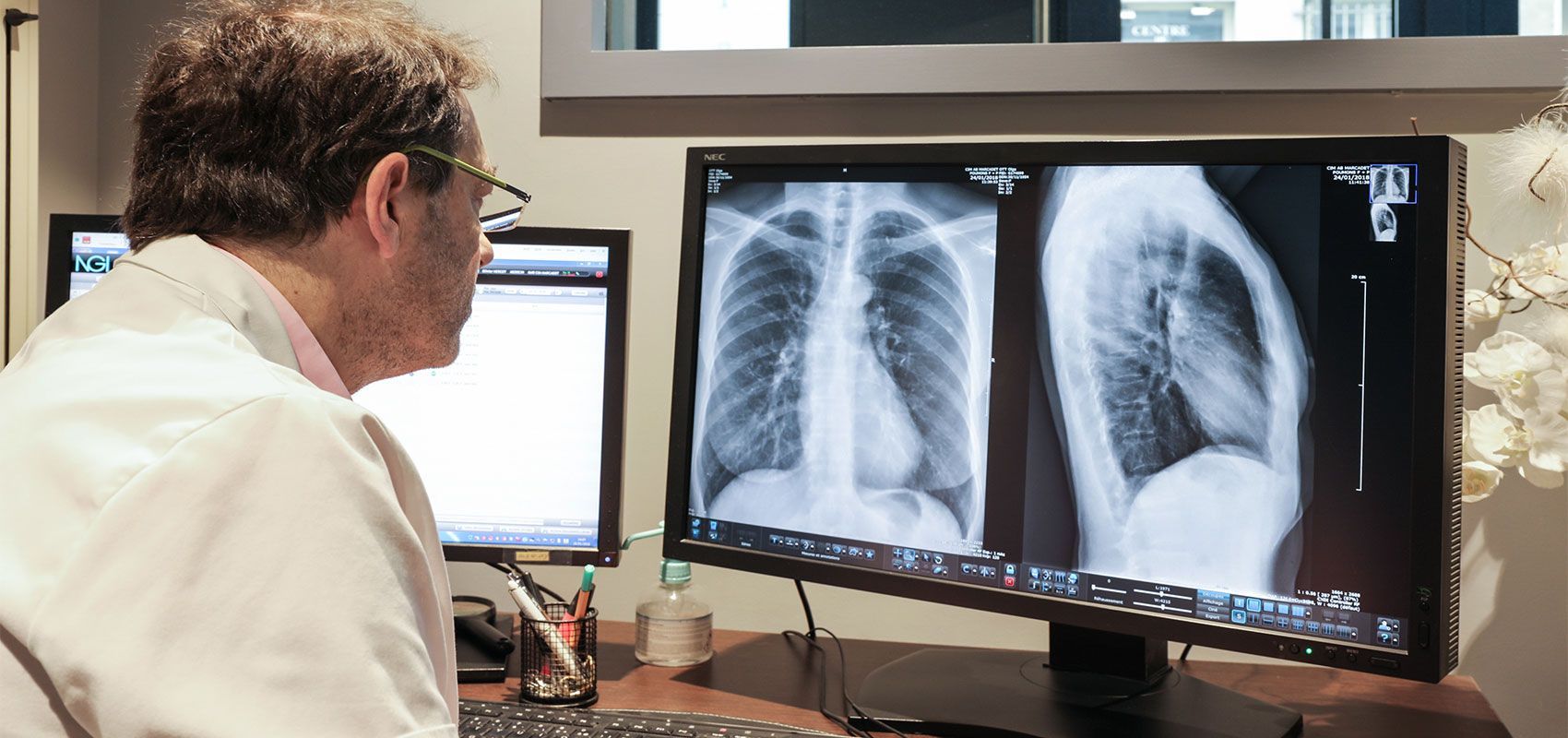 Un médecin examine des radiographies pulmonaires sur deux écrans dans un cabinet médical.