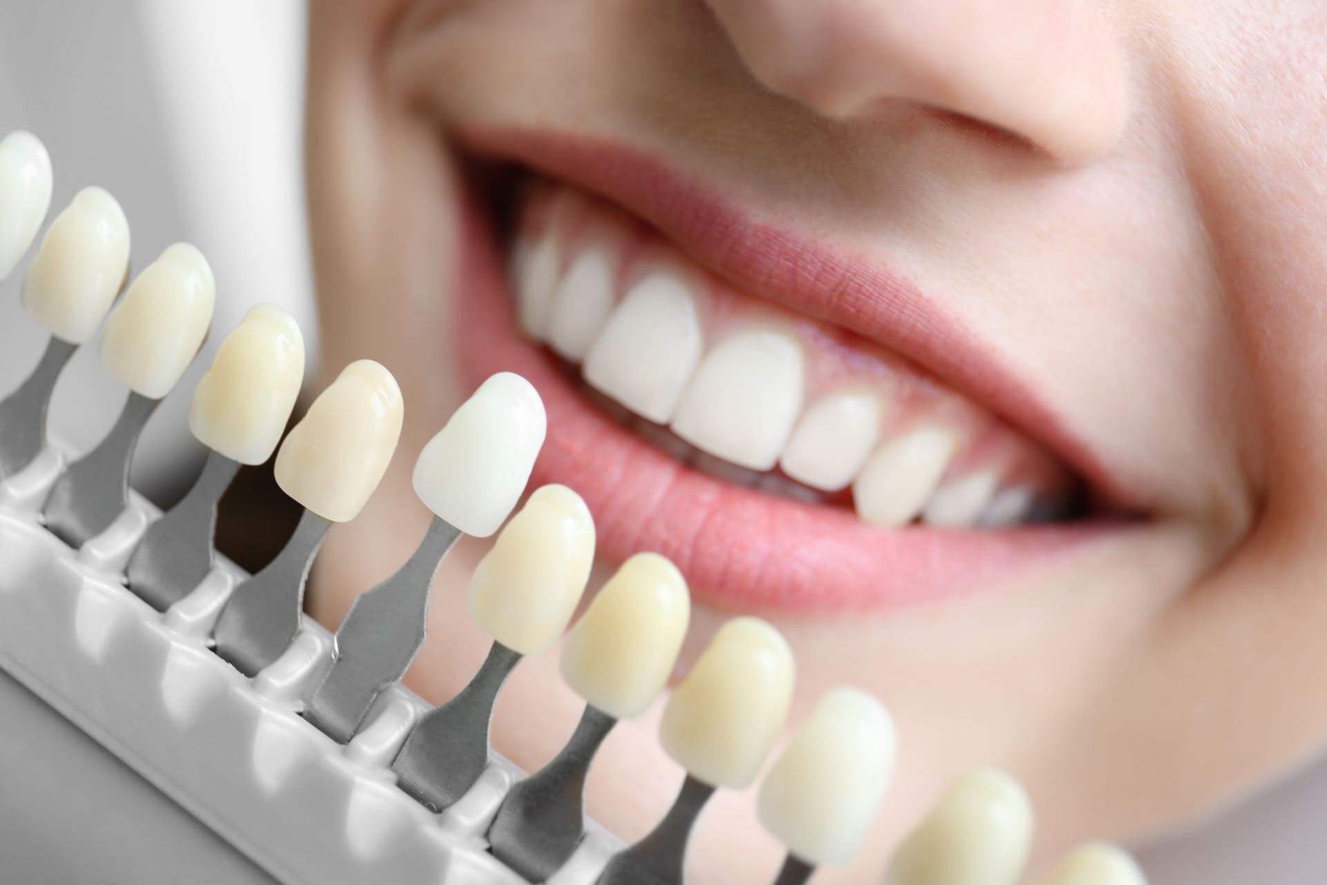 Zahnästhetik | Zahnarztpraxis am Wall Dr. Bode-Hirsch