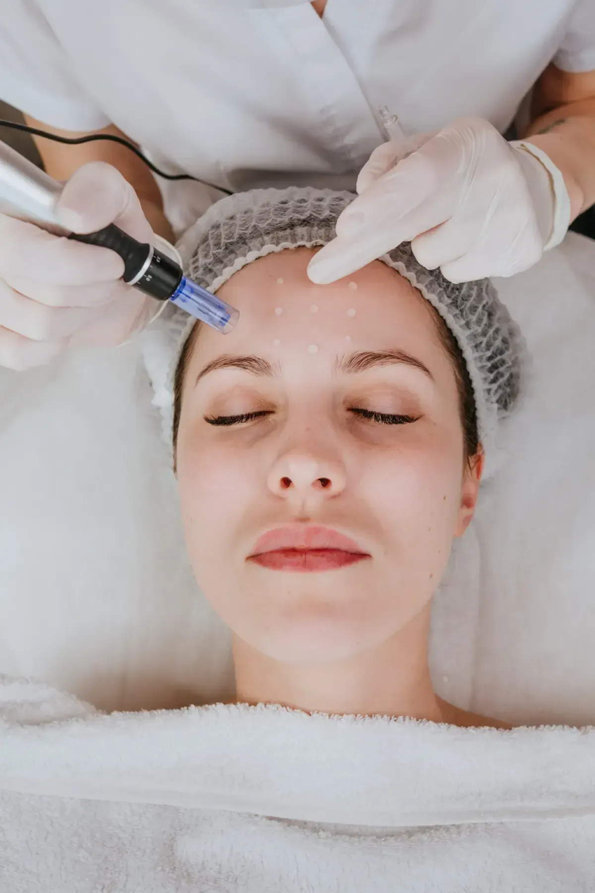 Un profesional utiliza una espátula ultrasónica para exfoliar la frente de una persona durante un tratamiento de spa.