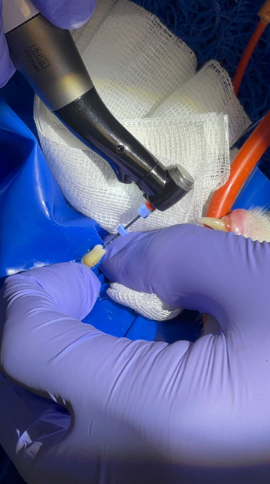 Ein Tierarzt verabreicht einem Hund mit einer Pipette Medizin; der Hund schaut mit offenem Maul nach oben.