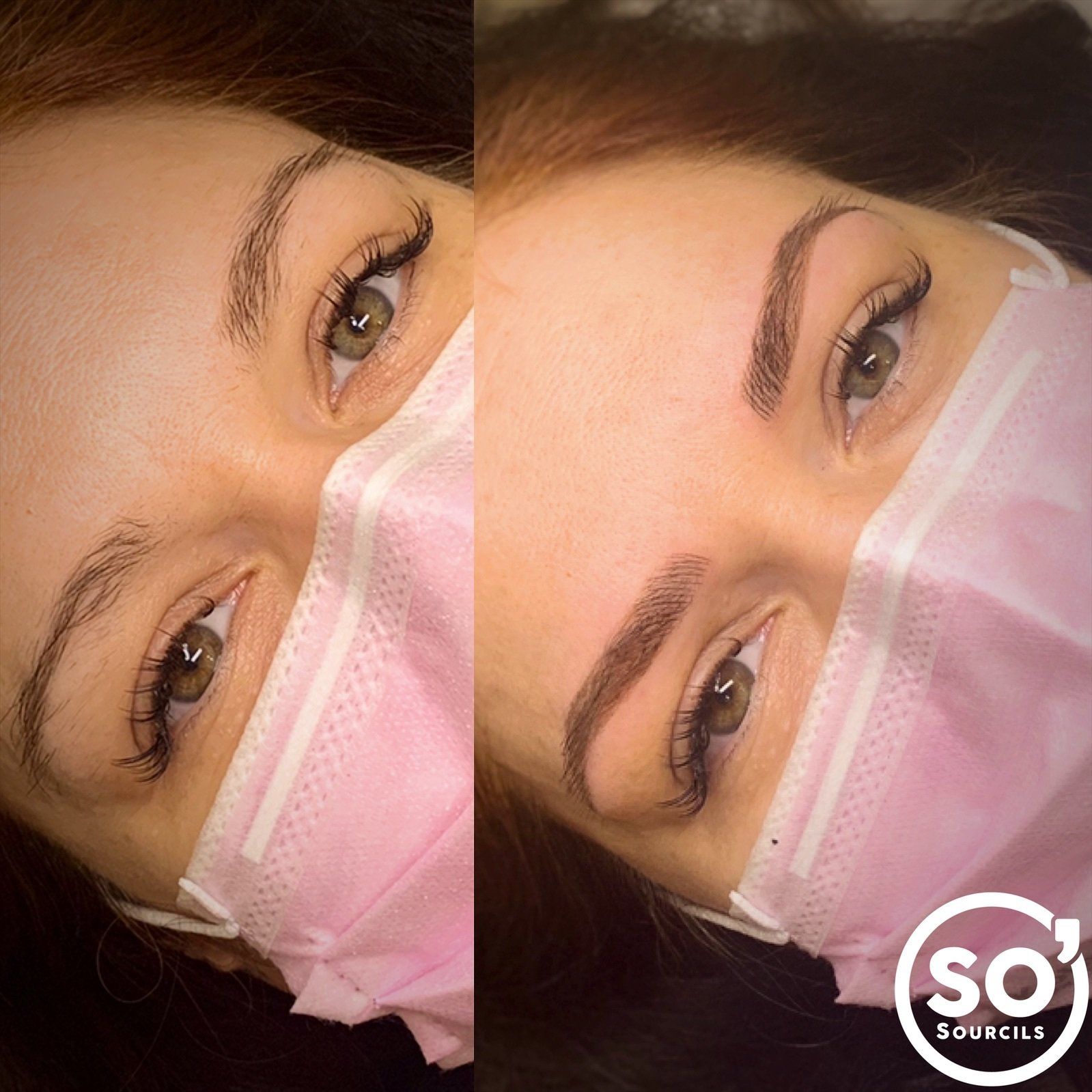 So'Sourcils, avant & après la technique