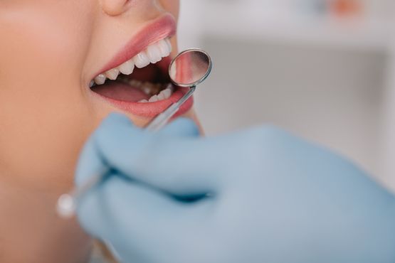 Person mit Handschuhen hält einen Spiegel an die Zähne einer Frau