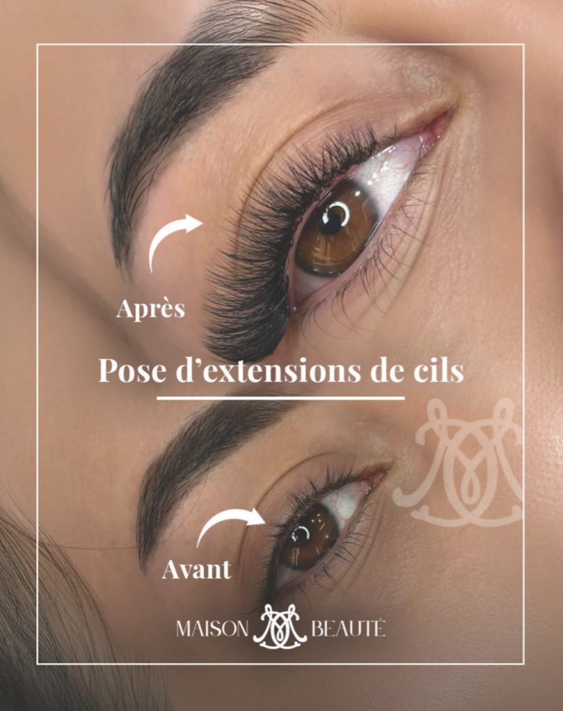 Comparaison de l'œil avec les cils naturels (avant) et les extensions de cils (après), démontrant l'effet de la procédure.
