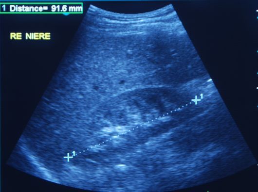 Abdominal ultrasound - Medizin im Schauspielhaus Group Practice