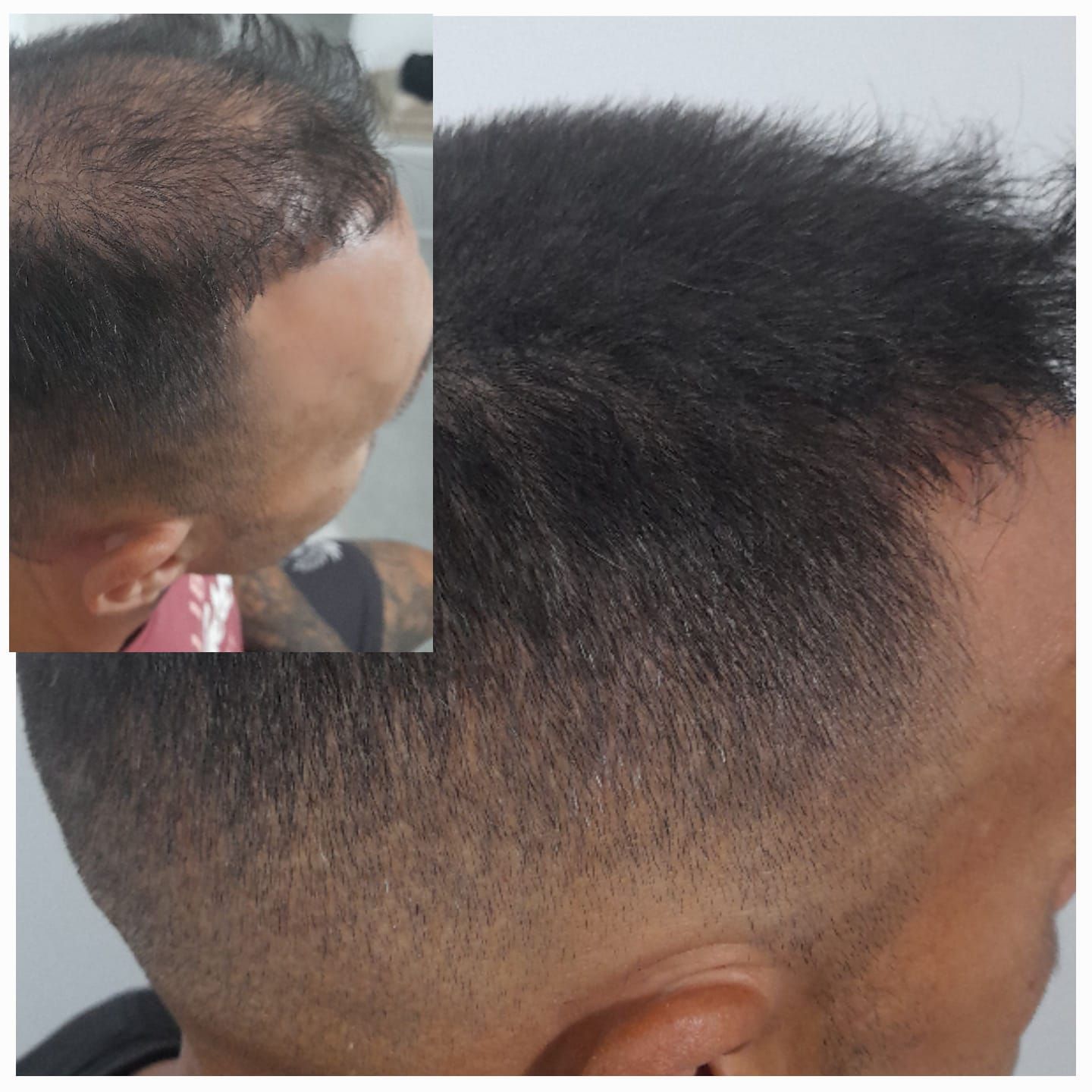 Un primer plano de la cabeza de un hombre con la cabeza rapada.