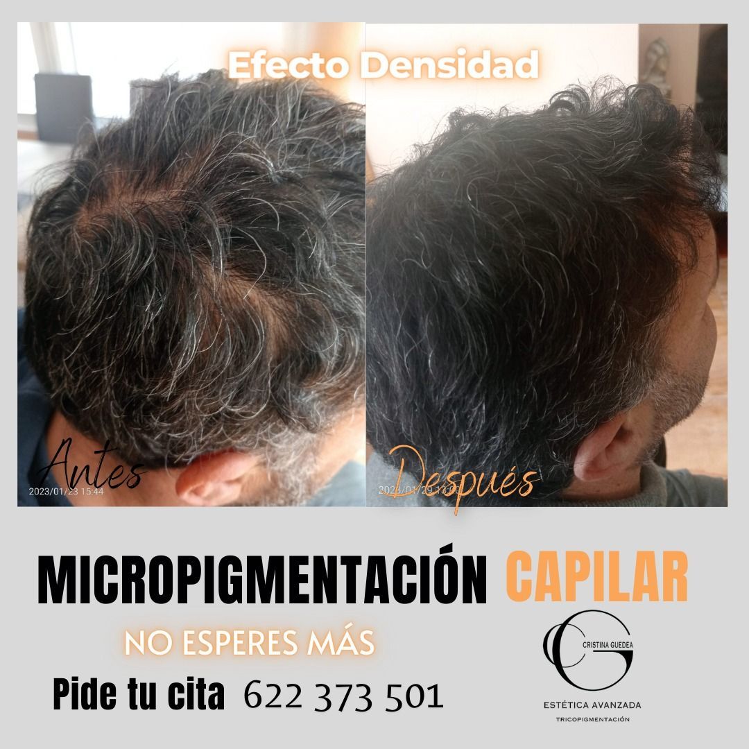 Una foto de antes y después del cabello de un hombre.