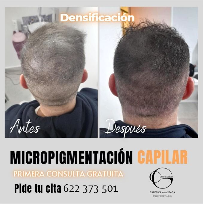 Una foto de antes y después del cabello de un hombre.