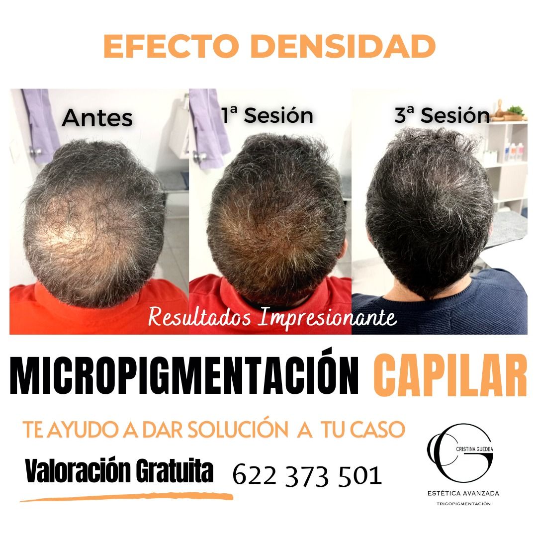 Una foto de antes y después del cabello de un hombre.