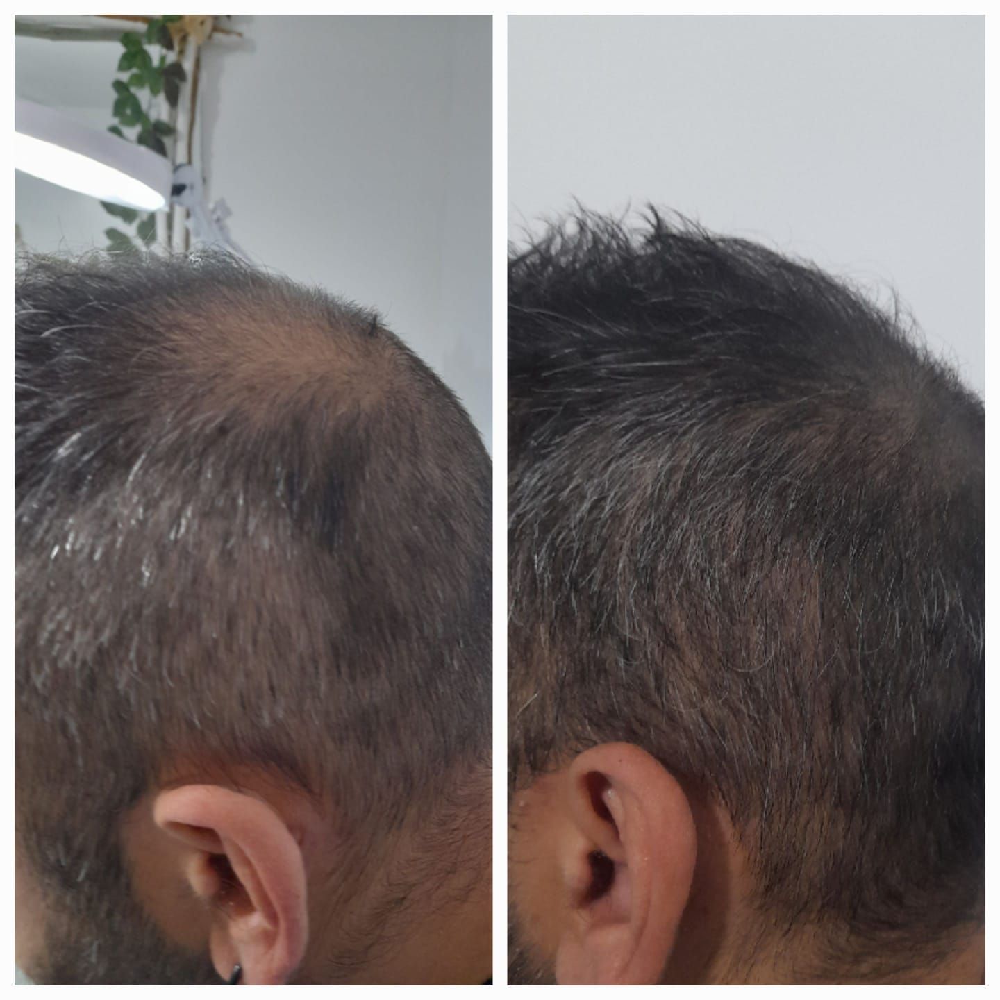 Una foto de antes y después del crecimiento del cabello de un hombre.