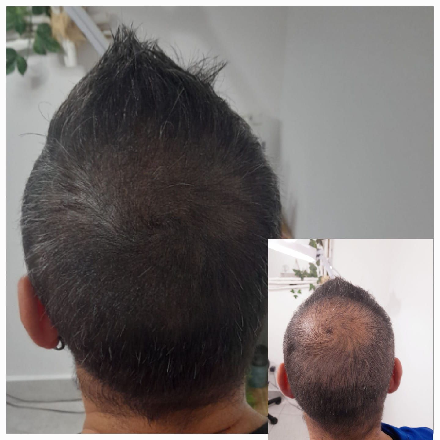 Una foto de antes y después del cabello de un hombre.