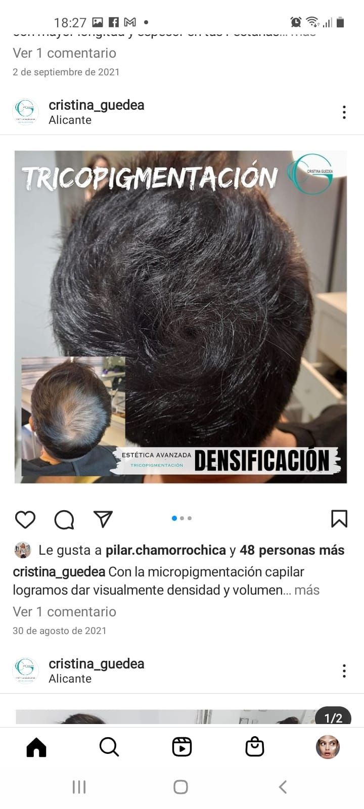 Una foto del cabello de una persona en un teléfono celular.