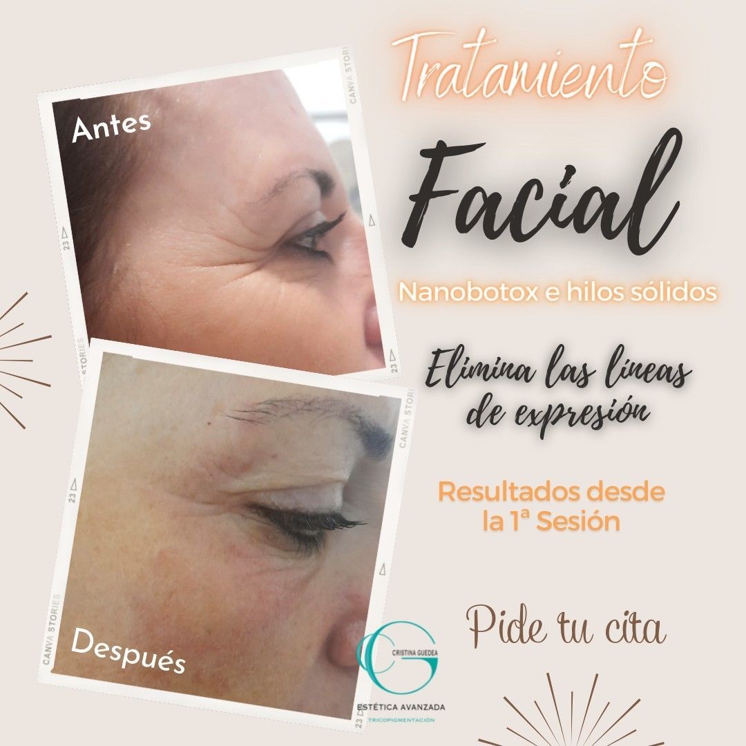 Una foto de antes y después de la cara de una mujer.