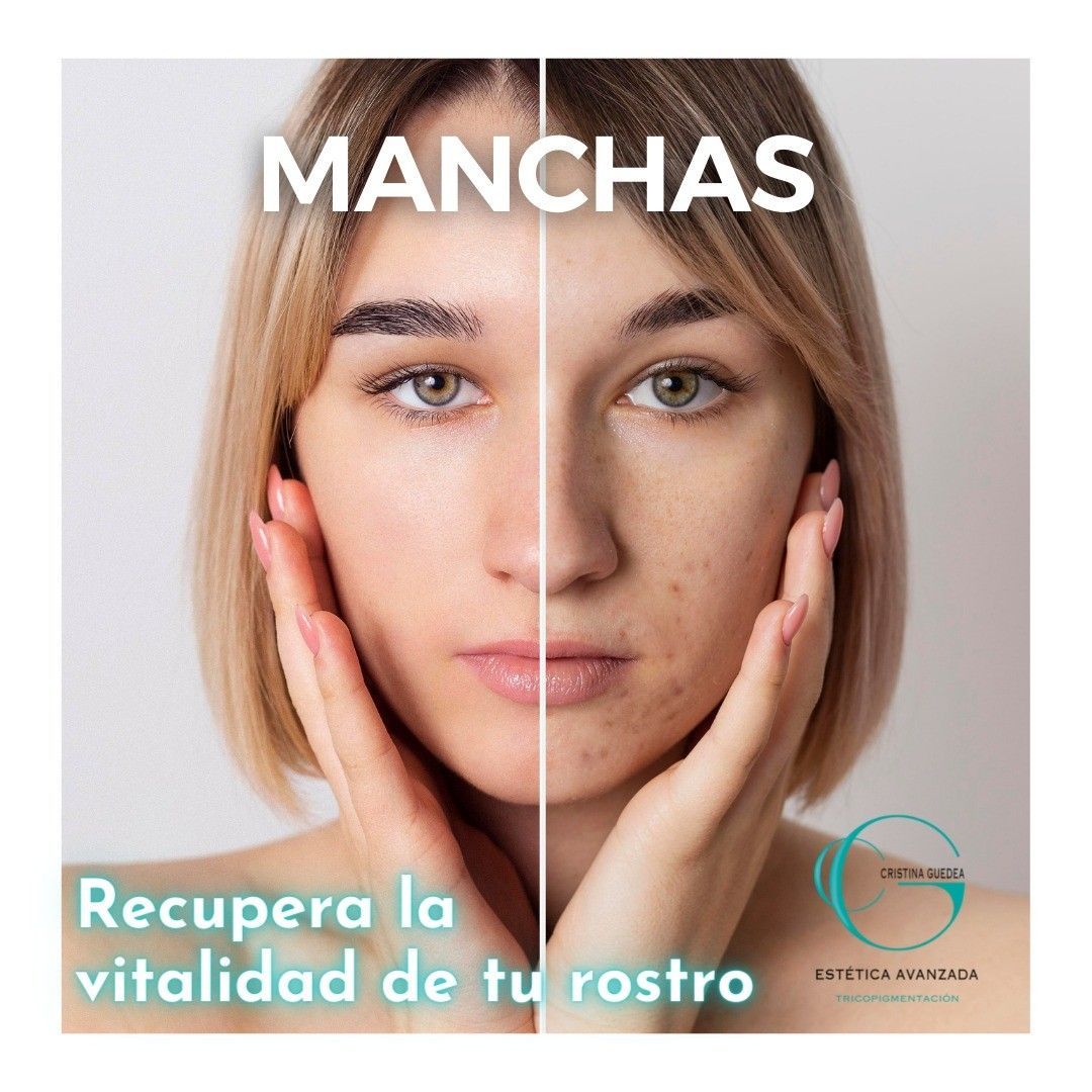 Una foto de antes y después del rostro de una mujer con las palabras manchas recupera la vitalidad de tu rostro