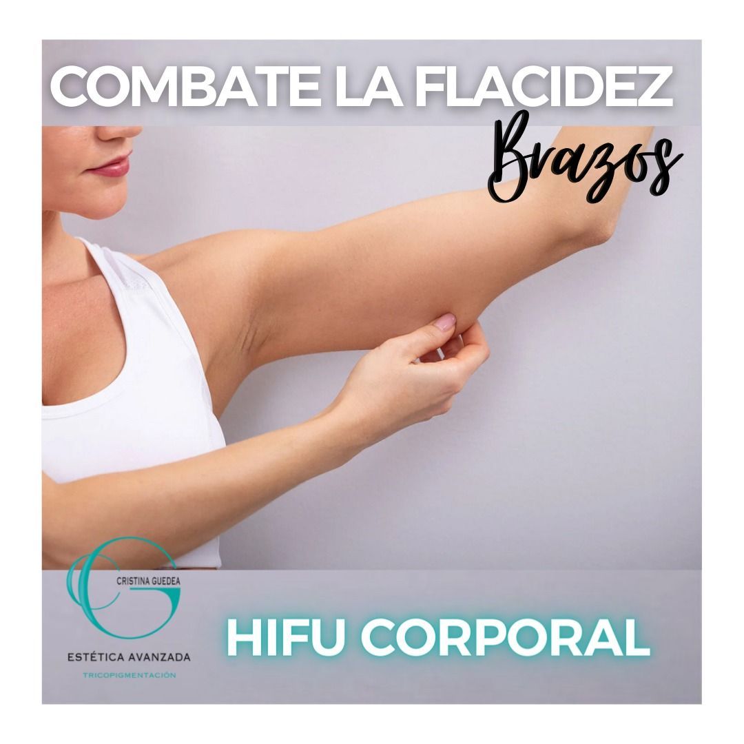 Se muestra el brazo de una mujer con las palabras Combate la flacidez brazos en la parte inferior.