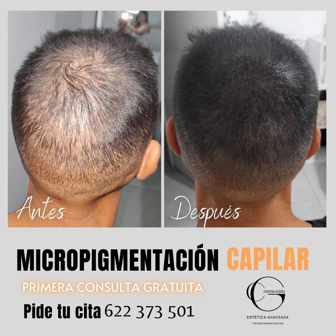 Una fotografía de antes y después del cabello de una persona.