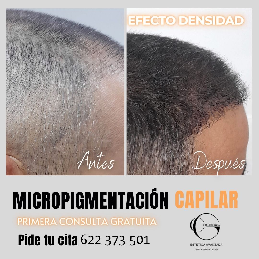 Una foto de antes y después del cabello de un hombre.