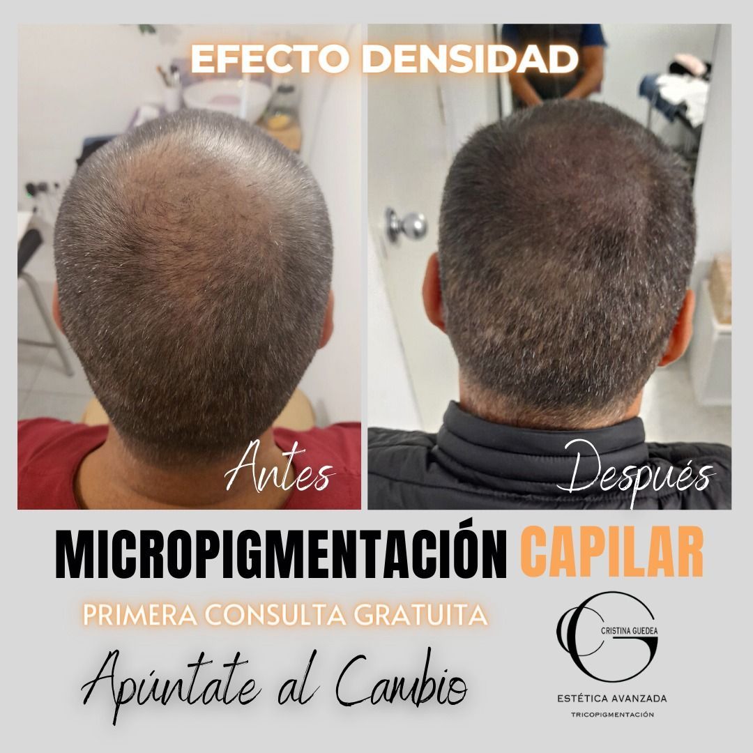 Una foto de antes y después del cabello de un hombre.