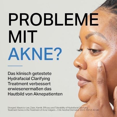 Eine Werbung für die HydraFacial-Aknebehandlung, bei der eine Person auf ihre Wange zeigt, mit deutschem Text.