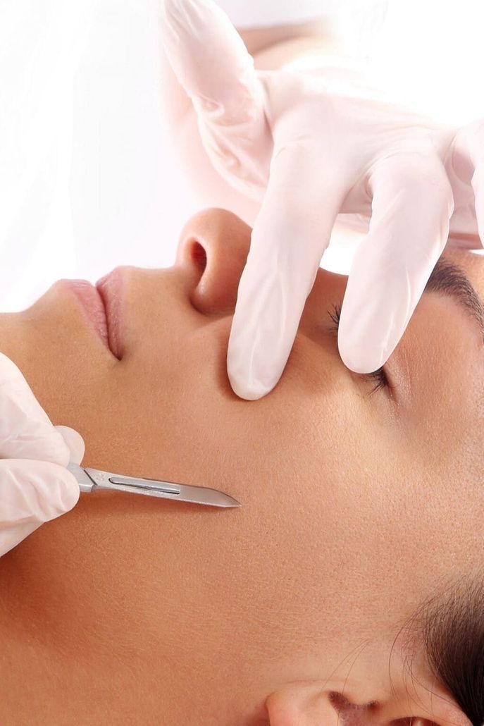 Eine Person mit weißen Handschuhen führt an einer Kundin eine Dermaplaning-Gesichtsbehandlung mit einer kleinen Skalpellklinge durch.