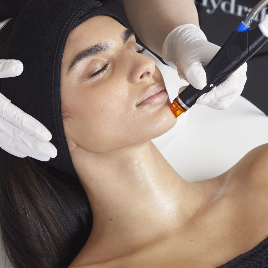 Eine professionelle Kosmetikerin mit Handschuhen wendet in einer Hautpflegeklinik ein handgeführtes HydraFacial-Gerät am Kinn einer Kundin an.