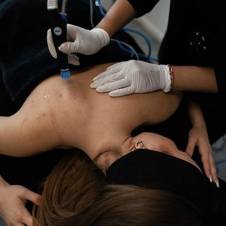 Eine Kosmetikerin in weißen Handschuhen behandelt mit einem handgeführten Kosmetikgerät die Haut am oberen Rücken einer Person.