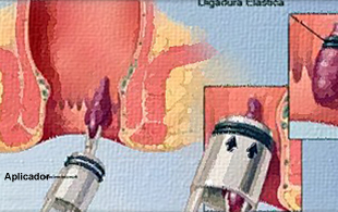 Muestra una intervención medica