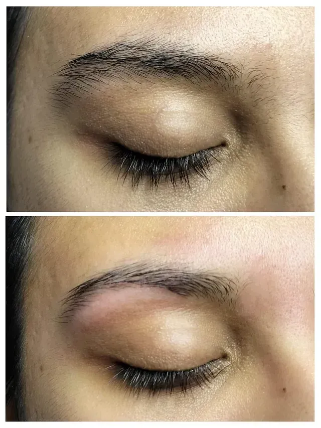 Comparación de la apariencia de las cejas: antes y después de un procedimiento de modelado.