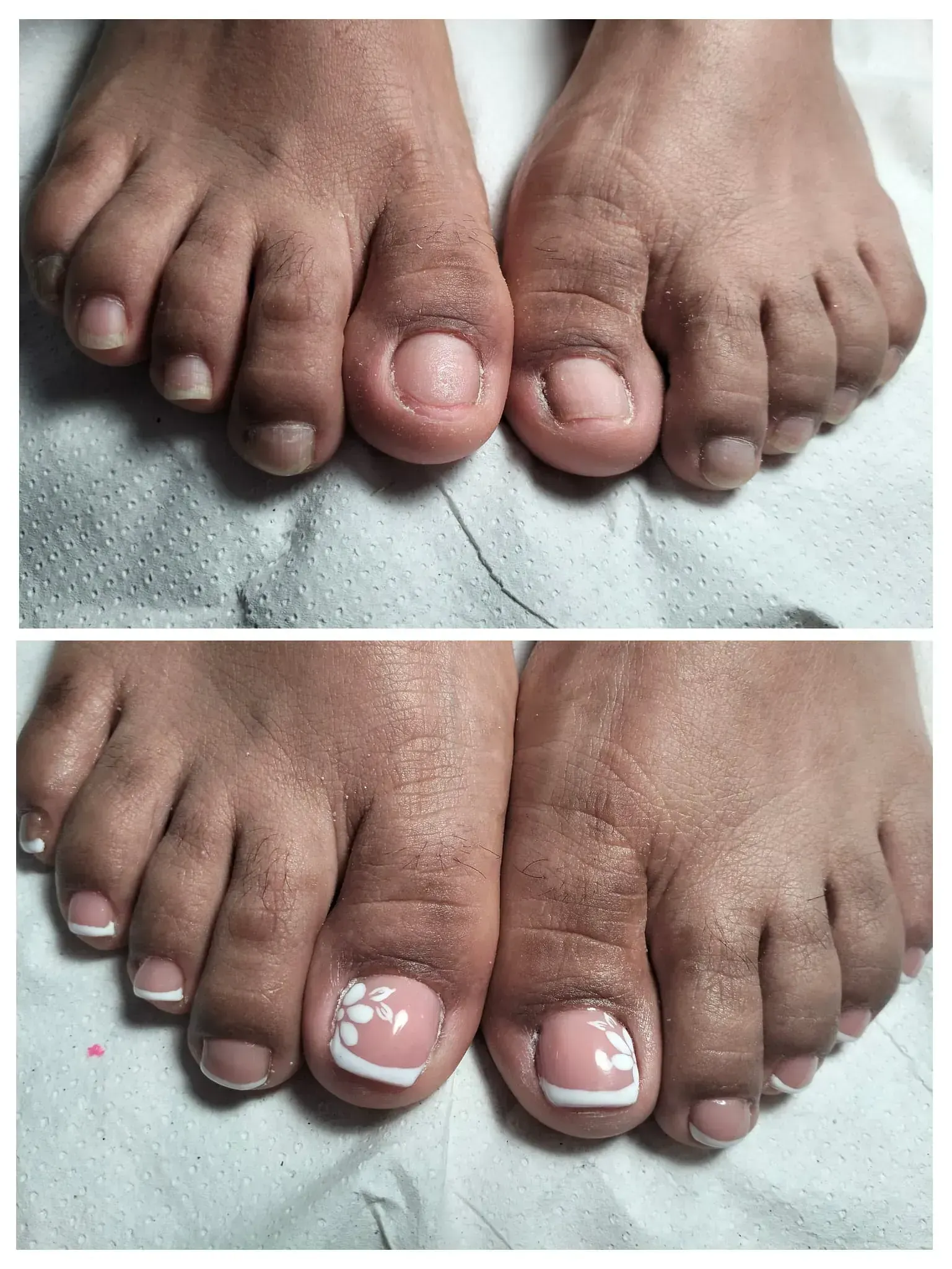 Dos pares de pies antes y después de una pedicura. Puntas francesas y diseño de flores blancas.