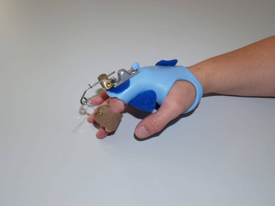 Übungen zur Mobilität der Finger