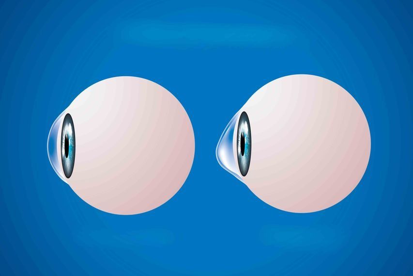 Un par de ojos con lentes de contacto sobre un fondo azul.