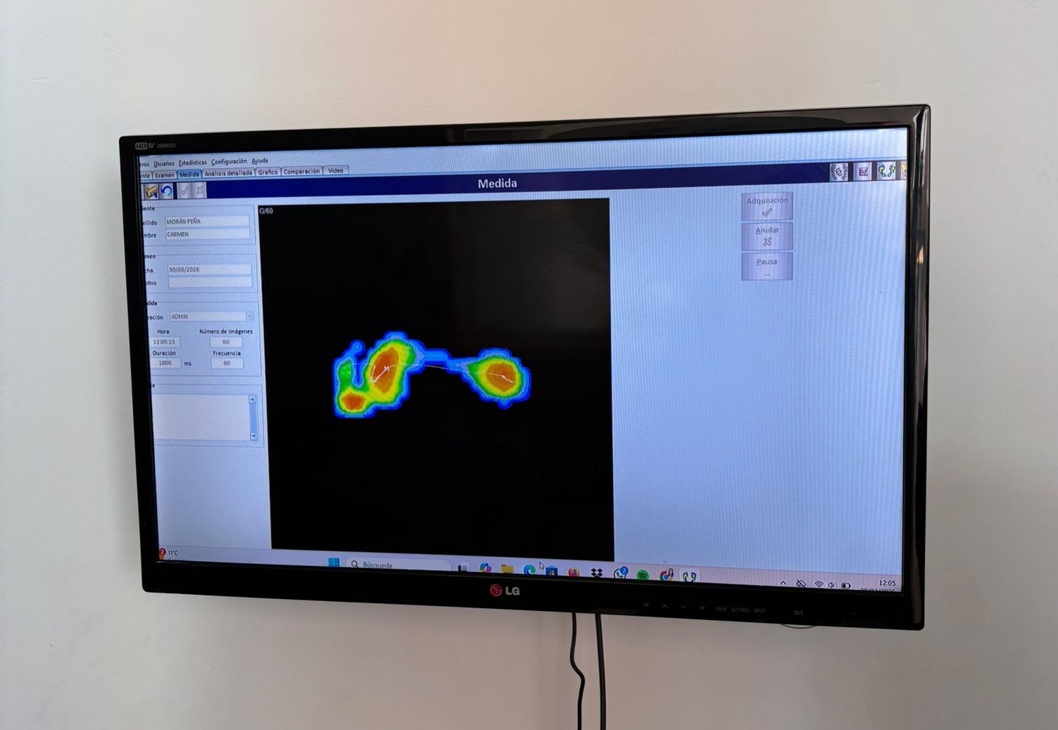 Monitor montado en la pared que muestra un mapa de calor colorido en una interfaz de software.