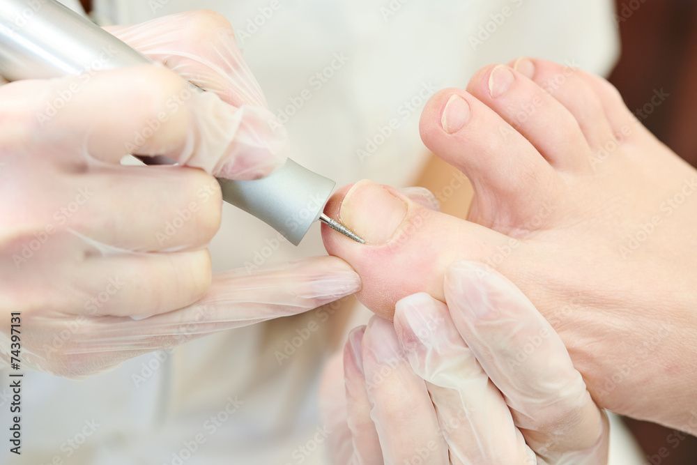 Der Fuß einer Person wird in einem Nagelstudio von einer Person mit Handschuhen mit einem Nagelfräser behandelt.