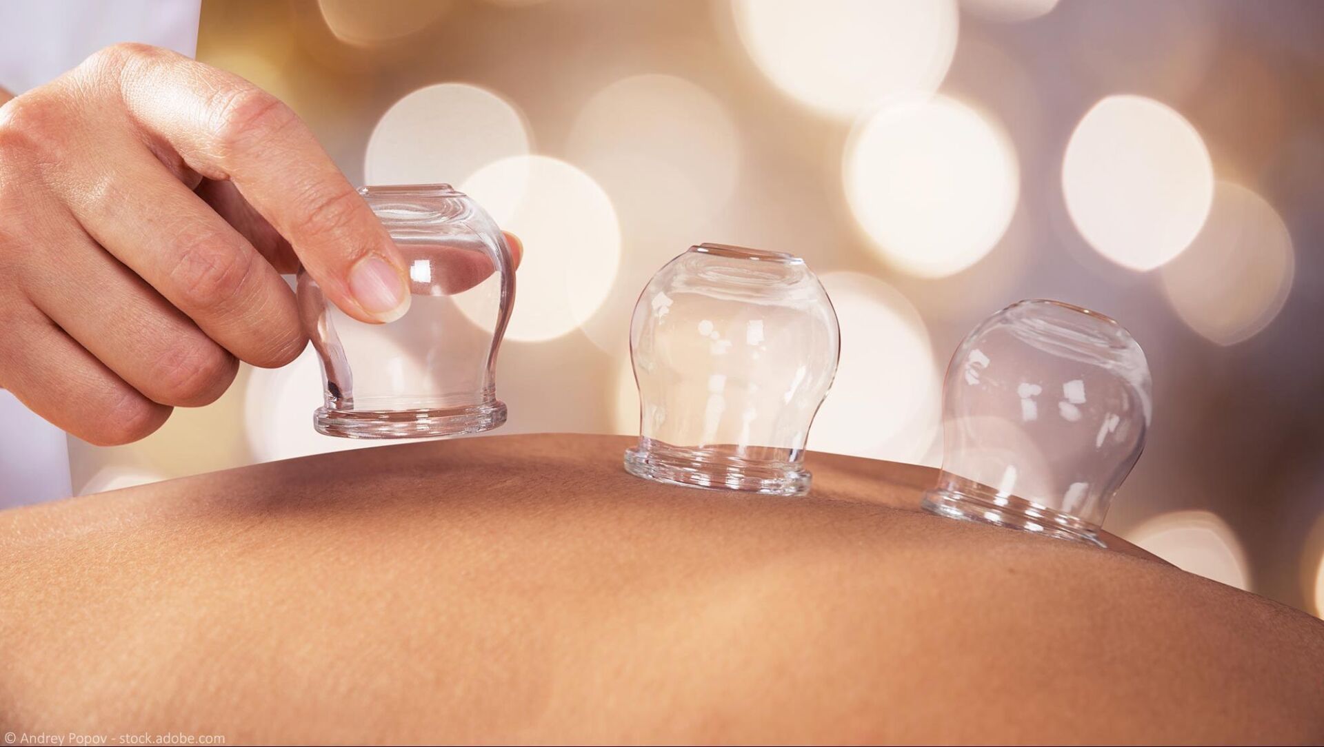 Schmerztherapie mittels Schröpfen