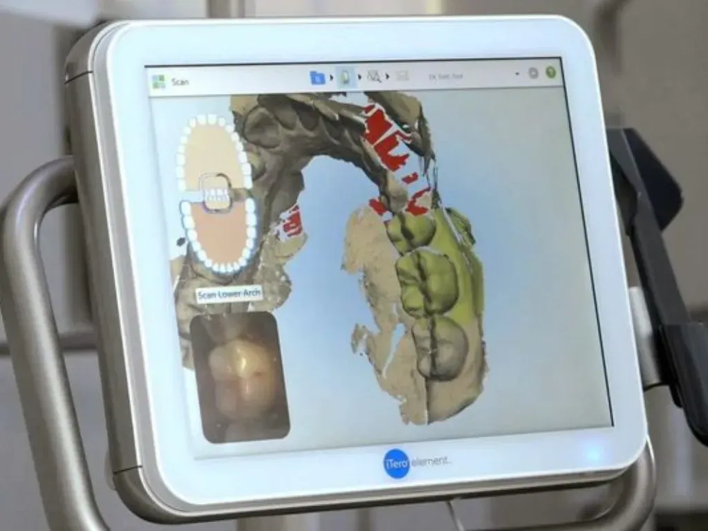 Dentista utilizando un taladro dental en el diente de un paciente.