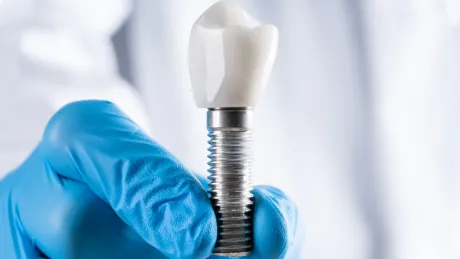 Implante dental sostenido por una mano enguantada. El implante lleva una corona dental, colocada delante de una bata blanca.