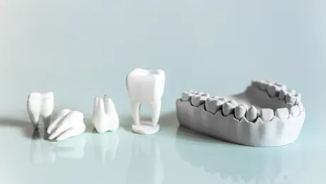 Dentista puliendo el diente de un paciente con un torno. El paciente sonríe.