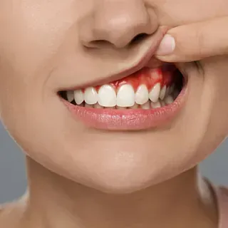 Una mujer muestra los dientes sosteniendo su labio con el dedo.