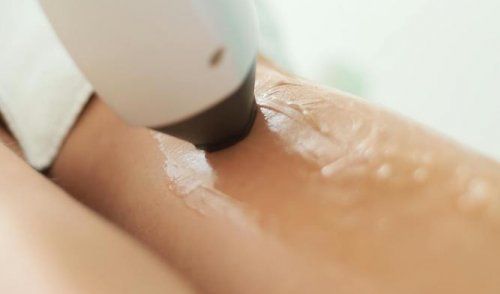 Gros plan sur un appareil d'épilation laser appliquant de la lumière sur la peau d'une personne recouverte d'un gel transparent.