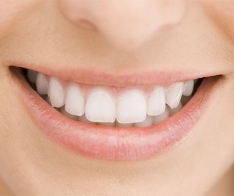 Primer plano de una boca sonriente con dientes blancos y labios rosados suaves.